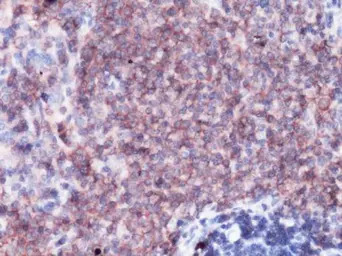 CD31 antibody [GT0010]