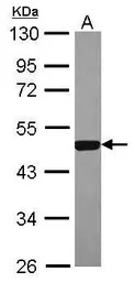 ERR alpha antibody [N1C3]