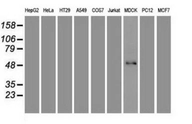 FOXA1 antibody [3A8]
