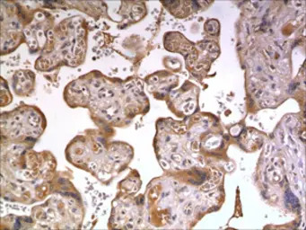 IL20 Receptor alpha antibody [