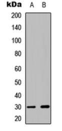 CDK5 (phospho Tyr15) antibody