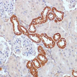 PDGF Receptor beta antibody