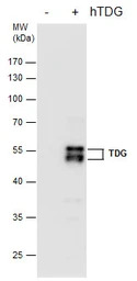 TDG antibody [GT1511]