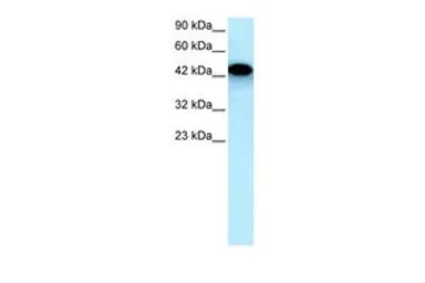 EYA3 antibody, Internal