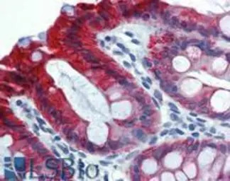Cytokeratin 18 antibody [C-04]
