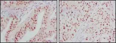 ATP2C1 antibody [4G12]