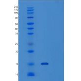 人肝素结合EGF样生长因子/前HB-EGF重组蛋白C-6His产品图