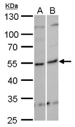 KHDRBS3 antibody