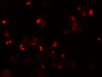 CD229 antibody