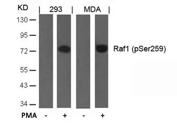Raf1 (phospho Ser259) antibody