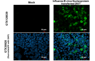 Influenza B virus Nucleoprotei