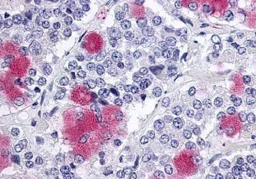 Glucagon like peptide 2 recept