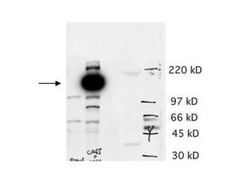 CASZ1 antibody