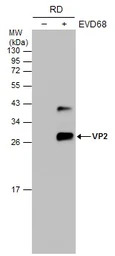 Enterovirus D68 VP2 antibody