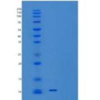 人C-X-C基序趋化因子7/CXCL7/NAP-2重组蛋白C-6His