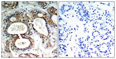 SHP2 (phospho Tyr542) antibody