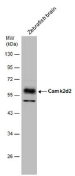 CaMKII delta antibody