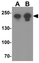 MYH8 antibody