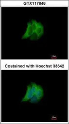 RAB17 antibody [N1C3]