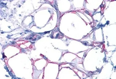 Glucagon receptor antibody