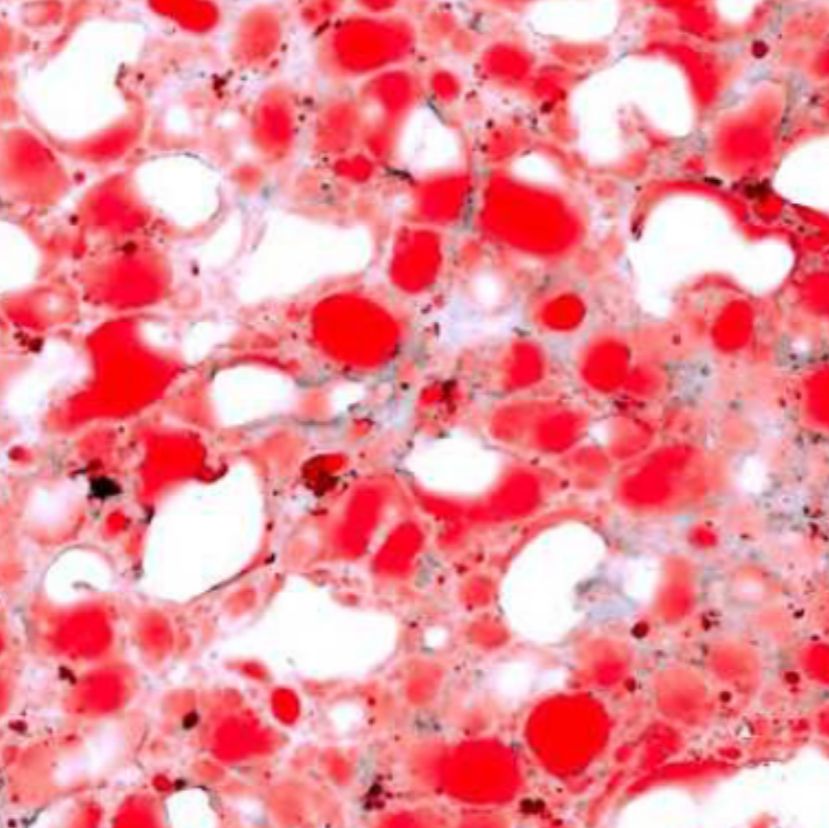 油红O染色(脂肪）