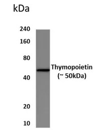 LAP2 antibody [8S37]