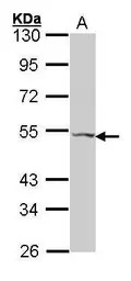 VPAC2 antibody