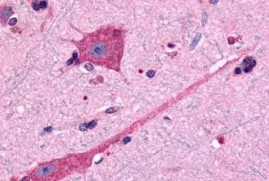 Dopamine Receptor D2 antibody