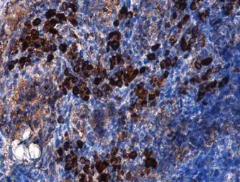 CD31 antibody [GT0010]