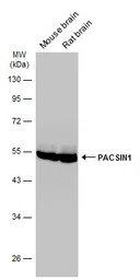 PACSIN1 antibody