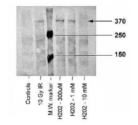 ATM (phospho Ser1981) antibody
