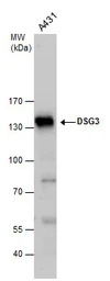 Desmoglein 3 antibody