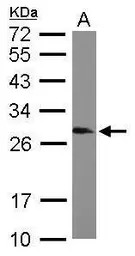 SNRPB antibody