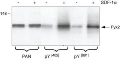 PYK2 (phospho Tyr402) antibody