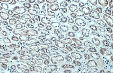 CXCR5 antibody [C1C2], Interna