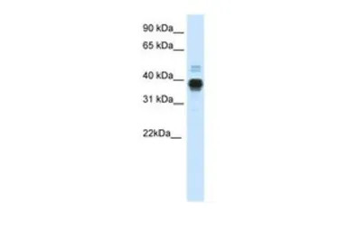 HOXA11 antibody, C-term