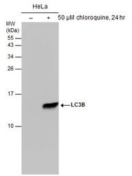 LC3B antibody [GT3612]