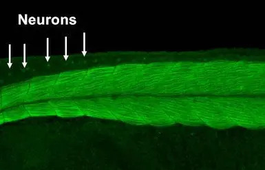 PKA C alpha antibody