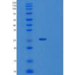 人Sentrin特异性蛋白酶8/SENP8重组蛋白N-6His