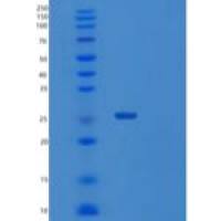 人Sentrin特异性蛋白酶8/SENP8重组蛋白N-6His