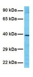KCNK9 antibody, N-term