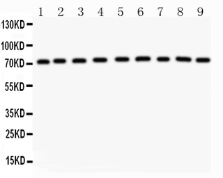 Growth hormone Receptor antibo