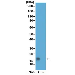 Histone H3T11ph (phospho Thr11