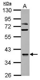 OXSM antibody