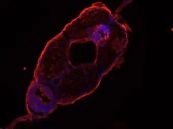TCP1 epsilon antibody [N1C1]
