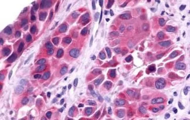 Trace Amine receptor 4 antibod