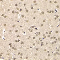 Casein Kinase 1 epsilon antibo