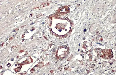 AMID antibody [N1], N-term
