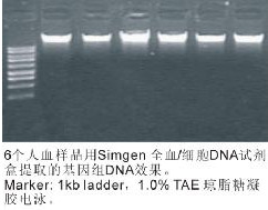 全血／培养细胞DNA试剂盒