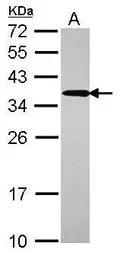 UBC3B antibody